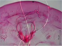 Parlatoria cinerea PaDIL141353b.jpg