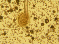 Aspergillus spores 160X.png