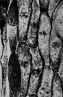 Cronartium ribicola J. C. Fisch. Abb0079 (Gäumann 1959, Rostpilze Mitteleuropas).png