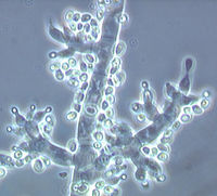 Trichoderma fertile.jpg