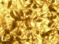 Alternaria spores 160X.png