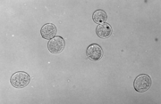 Bremia lactucae (print magn. x500, ID-1823466597, MBBr0003)