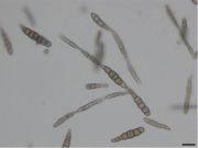 Alternaria brassicicola PaDIL140396a.jpg