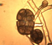 11. Already formed acanthaceous conidia.JPG