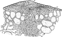 Hyalopsora Aspidiotus (Pk.) Magn. Abb0022 (Gäumann 1959, Rostpilze Mitteleuropas).png