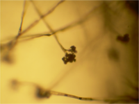 Botrytis conidiophore 40X.png