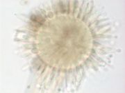 Aspergillus niger PaDIL142992b.jpg