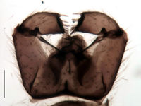 Leptosciarella dentata Hypopygium HT.jpg