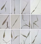 Alternaria crassa StudMycol 2014.jpg