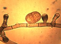 10. Conidiophores and a conidium on the mycelium.JPG