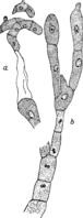 Chrysomyxa abietis (Wallr.) Ung. Abb0087 (Gäumann 1959, Rostpilze Mitteleuropas).png