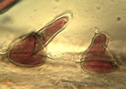 10. Вeginning of formation of Heterosporium gracile conidiophores. (Image by G. Pestsov)