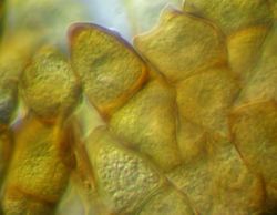 24. Сoarctate and truncated teliospores of Puccinia allii (Image by G. Pestsov).