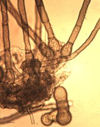 13. Сonidia, conidiophores and stromata from host. (Image by G. Pestsov)