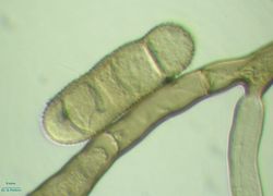 26. Сonidium and conidiophore of Heterosporium gracile. (Image by G. Pestsov)