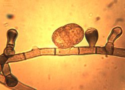 10.Conidiophores and a conidium on the mycelium.JPG (Image by G. Pestsov)