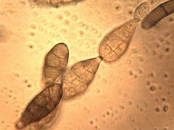 13. Conidia chain.JPEG (Image by G. Pestsov)