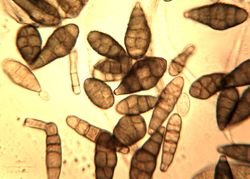 15. Diversity of the conidia sizes and colorings.JPEG (Image by G. Pestsov)