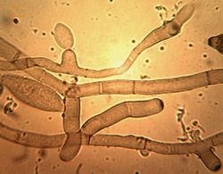 19. Conidiophores formation and beginning of conidia formation.JPEG (Image by G. Pestsov)