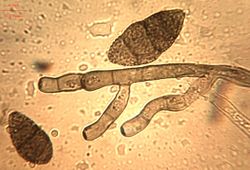 20. Conidiophores and verruculose conidia.JPEG (Image by G. Pestsov)