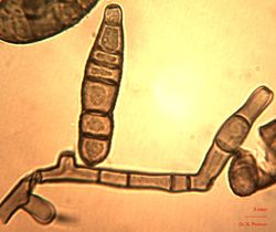 21. Conidiophore and conidium.JPEG (Image by G. Pestsov)