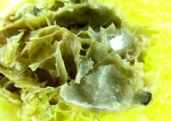 4. Maceration of the tissues and beginning of the sporification.JPEG (Image by G. Pestsov)