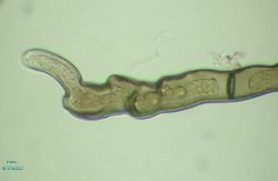 15. Apical growth of the Heterosporium gracile conidiophore. (Image by G. Pestsov)