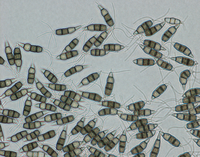 Conidia from PDA, 40x objective.