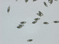 Conidia from PDA, 40x objective.