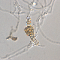 Acervulus or chlamydospore formation? 63x DIC objective.