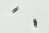 Conidia from PDA, 40x objective.