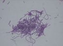 Bacillus thuringiensis.jpg