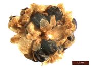 Blitum virgatum: Blütenknäuel in Fruchtreife, Wulferdingen, leg. E.M. Wentz (Herb. MSTR) (Foto: Rolf Wißkirchen)