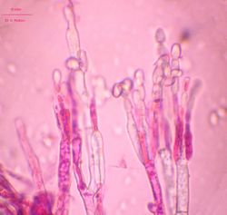 Figure 9.Conidiophores of the fungus Penicillium italicum.jpg (Image by G. Pestsov)