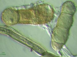 24. Conidia and hyphae of endogenec Heterosporium gracile mycelium. (Image by G. Pestsov)