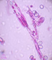 Figure 10.Conidia formation on sterigma.jpg (Image by G. Pestsov)