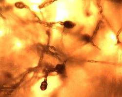 6. Conidia formation on the aerial mycelium of Stemphylium botryosum.jpg (Image by G. Pestsov)