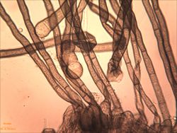 14. Conidiophores Heterosporium gracile and stromata from host. (Image by G. Pestsov)