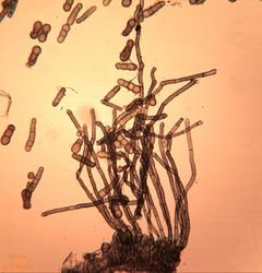 11. Conidiophores and conidia of Heterosporium gracile. (Image by G. Pestsov)