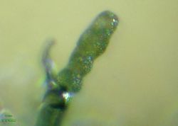 18. Conidium of Heterosporium gracile. (Image by G. Pestsov)