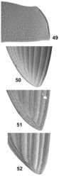 Figures 49–52. Additional diagnostic characters of West Indian Oosterum. (49) Pronotal punctation of Oosternum pecki. (50–52) Apical portion of elytra 50. Oosternum cercyonoides 51. Oosternum megnai 49, 52. Oosternum pecki.