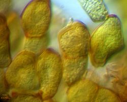 27. Dulled and rounded teliospores of Puccinia allii (Image by G. Pestsov).