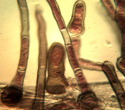 20. Formation of Heterosporium gracile conidiophores and conidia. (Image by G. Pestsov)