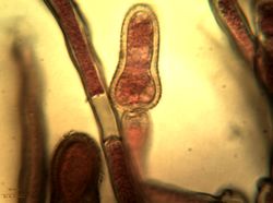 21. Formation of Heterosporium gracile conidium. (Image by G. Pestsov)