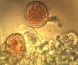 12. Formation of Puccinia allii urediniospores (Image by G. Pestsov).