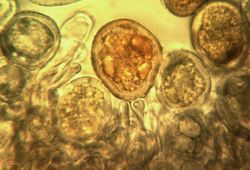 10. Formation of Puccinia allii urediniospores and paraphyses (Image by G. Pestsov).