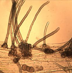 12. Formation of conidiophores on the leaf's surface. (Image by G. Pestsov)