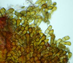 19. Formation of teliospores of Puccinia allii (Image by G. Pestsov).