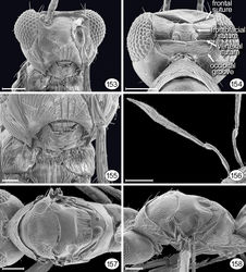 Figures 153–158. Proarescon similis. 153 male head, ventroanterior 154 female head and pronotum, posterodorsal 155 male lower face and prosternum 156 female antennae 157 female mesosoma, dorsal 158 male mesosoma, dorsolateral. Scale bar for 153, 154, 157, 158 = 50 μm; 155= 20 μm; 156 = 100 μm.