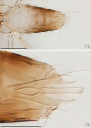 Figures 175, 176. Proarescon similis, male paratype. 175 metasoma, dorsal 176 genitalia, dorsal (seen through body). Scale bar for 175 = 100 μm; 176 = 50 μm.